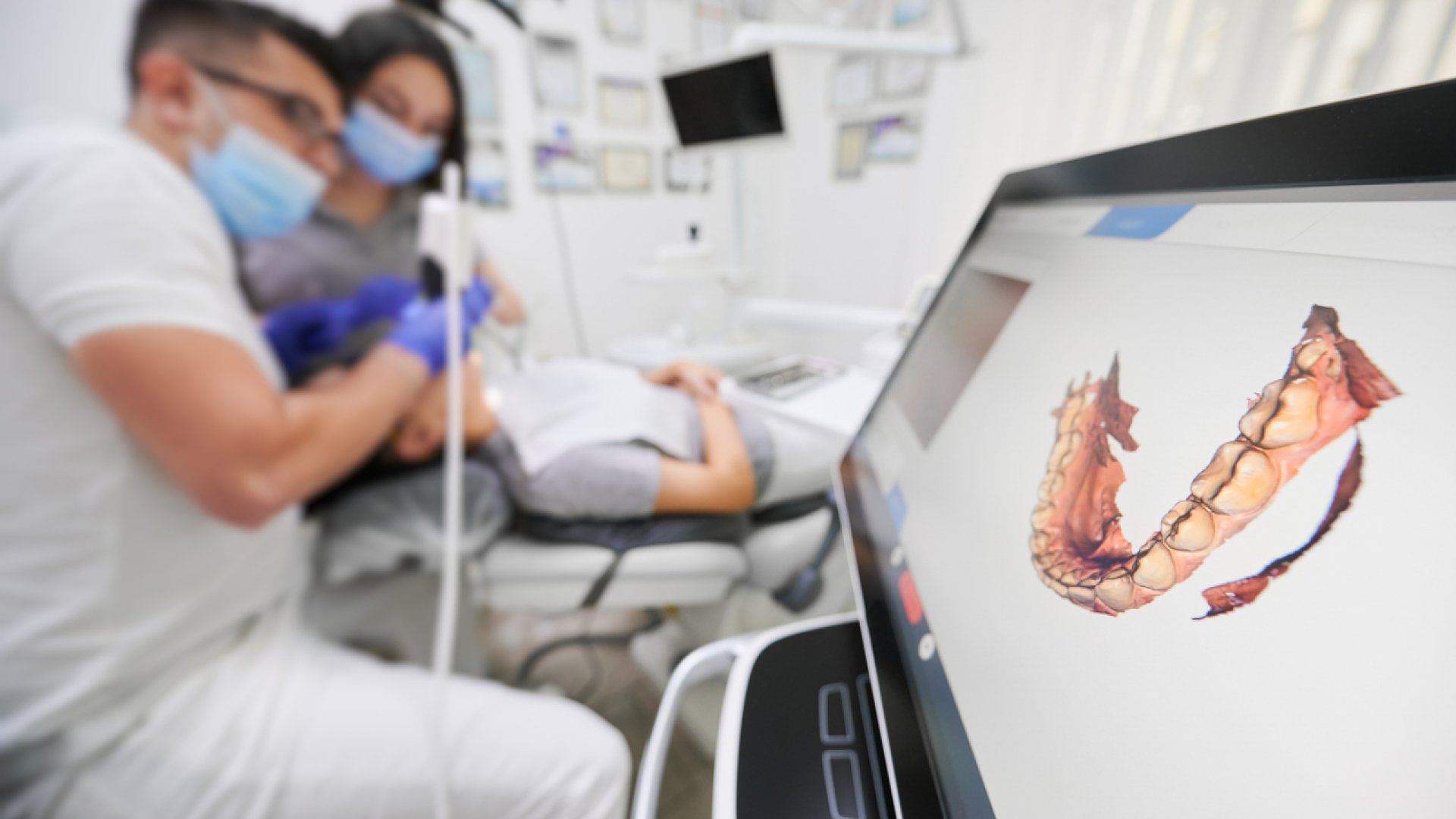 Digitális vs hagyományos mosolytervezés