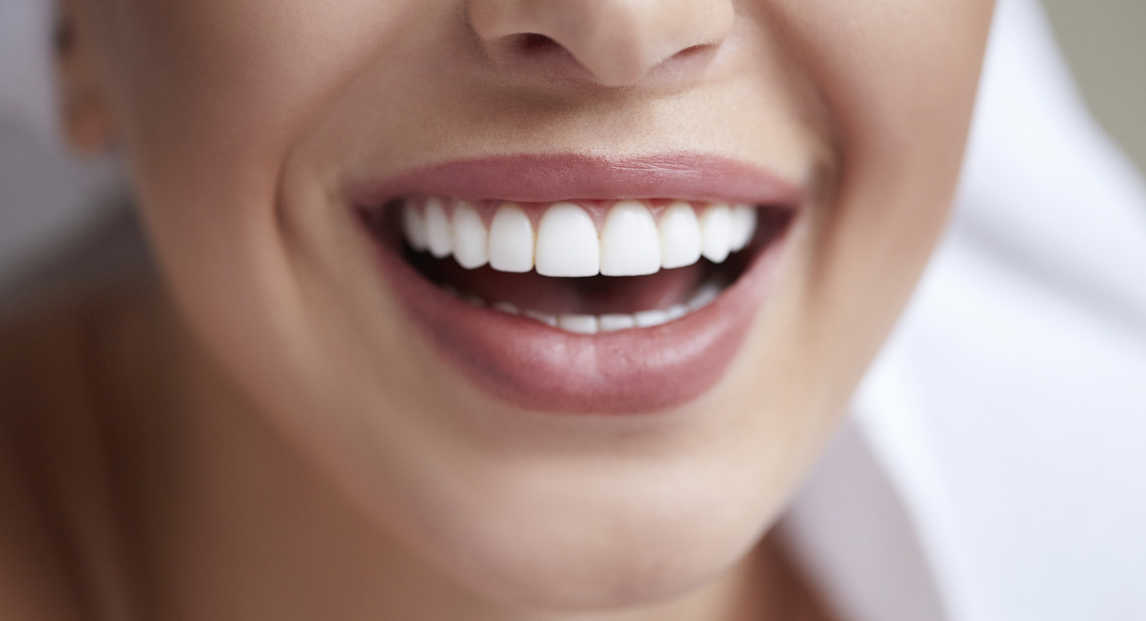 Híres emberek fogai: hogyan befolyásolta a mosolyuk a karrierjüket?
