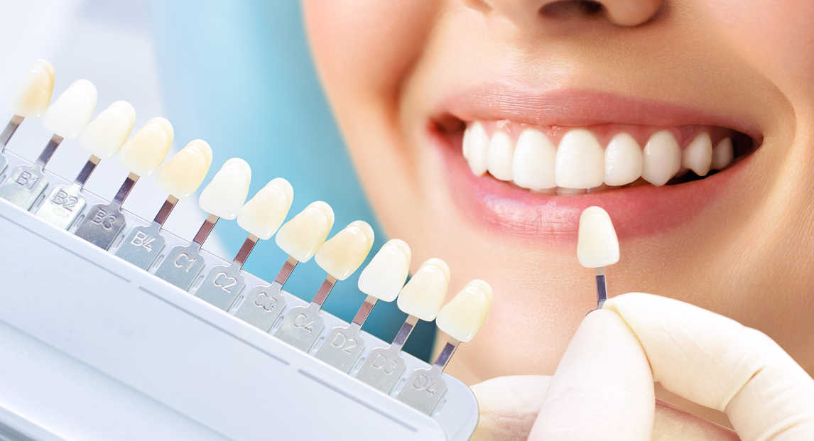 Mit jelent az esztétikai fogászat? Milyen kezeléseket takar?